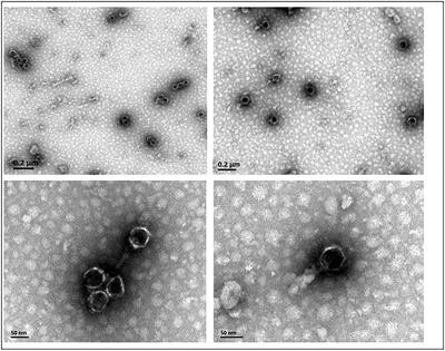 Isolation and Genomic Characterization of an Acinetobacter johnsonii Bacteriophage AJO2 From Bulking Activated Sludge